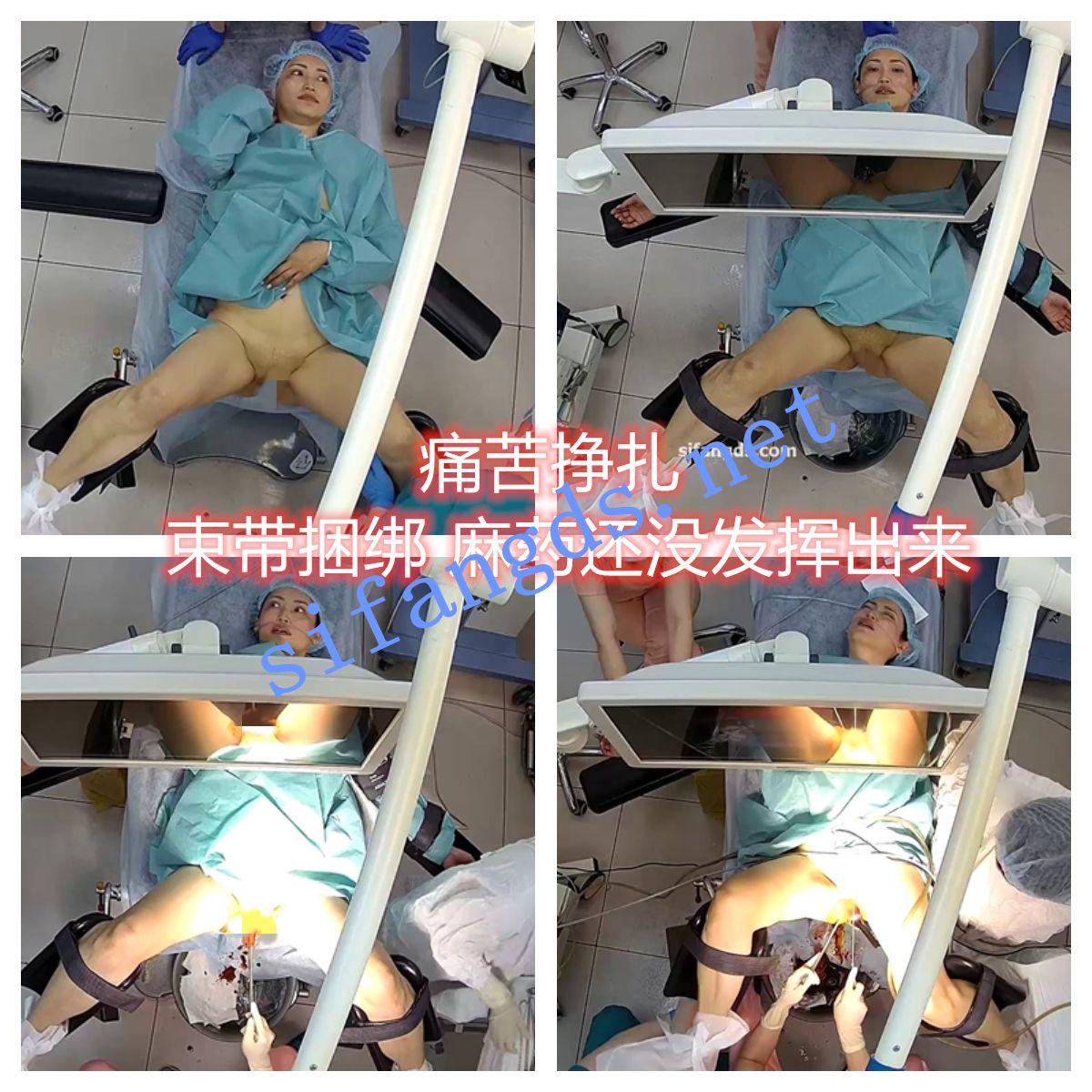 【妇科手术】麻醉后翻眼睛确认 麻醉过后痛苦不堪 动弹不得